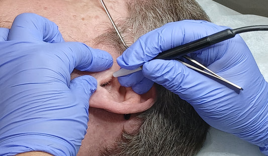 Hair Removal of Mid Michigan